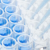 炎症用 | ELISA kit（研究用）96ウェルプレートフォーマット | 抗原抗体反応 | アトー製品情報 | ATTO